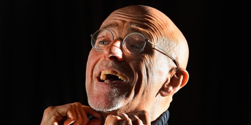 could dr sergio canavero perform head transplant