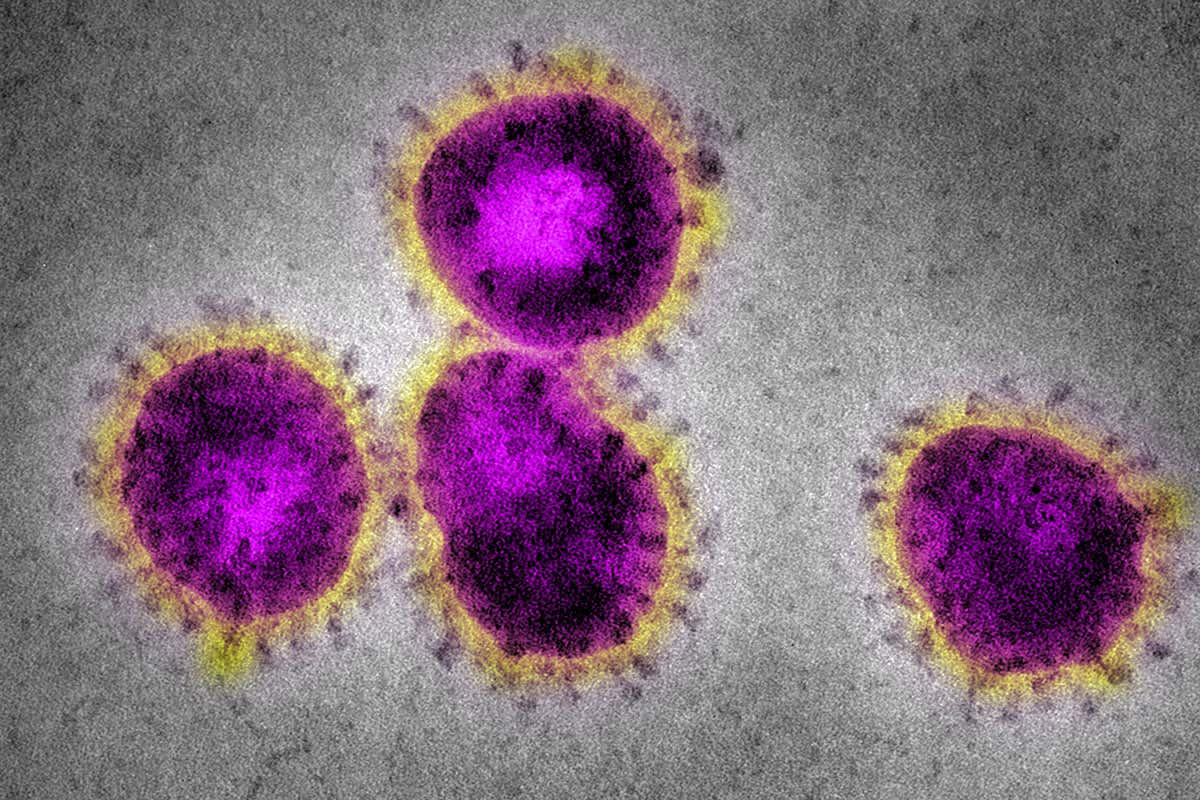 Huawei Armor ضد Coronavirus: تطور التشخيصات المتقدمة بنسبة نجاح 98 ٪ ودقيقتين 171