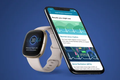 fitbit ekg