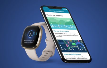 fitbit ekg