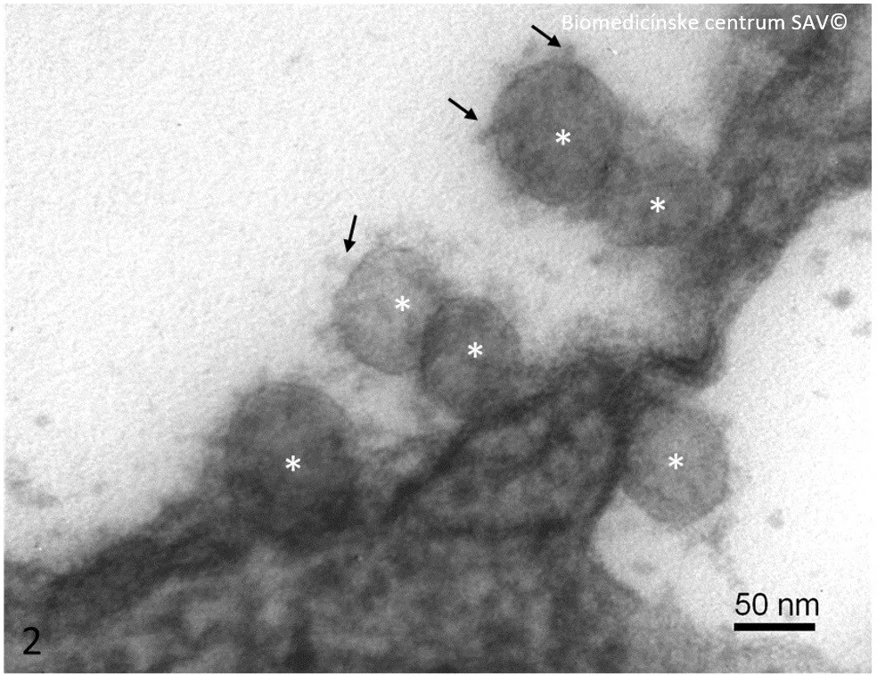 slovensky koronavirus sav jpg