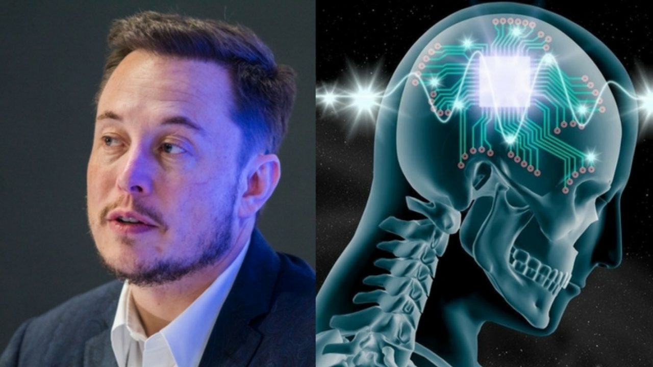 Mozgový implantát