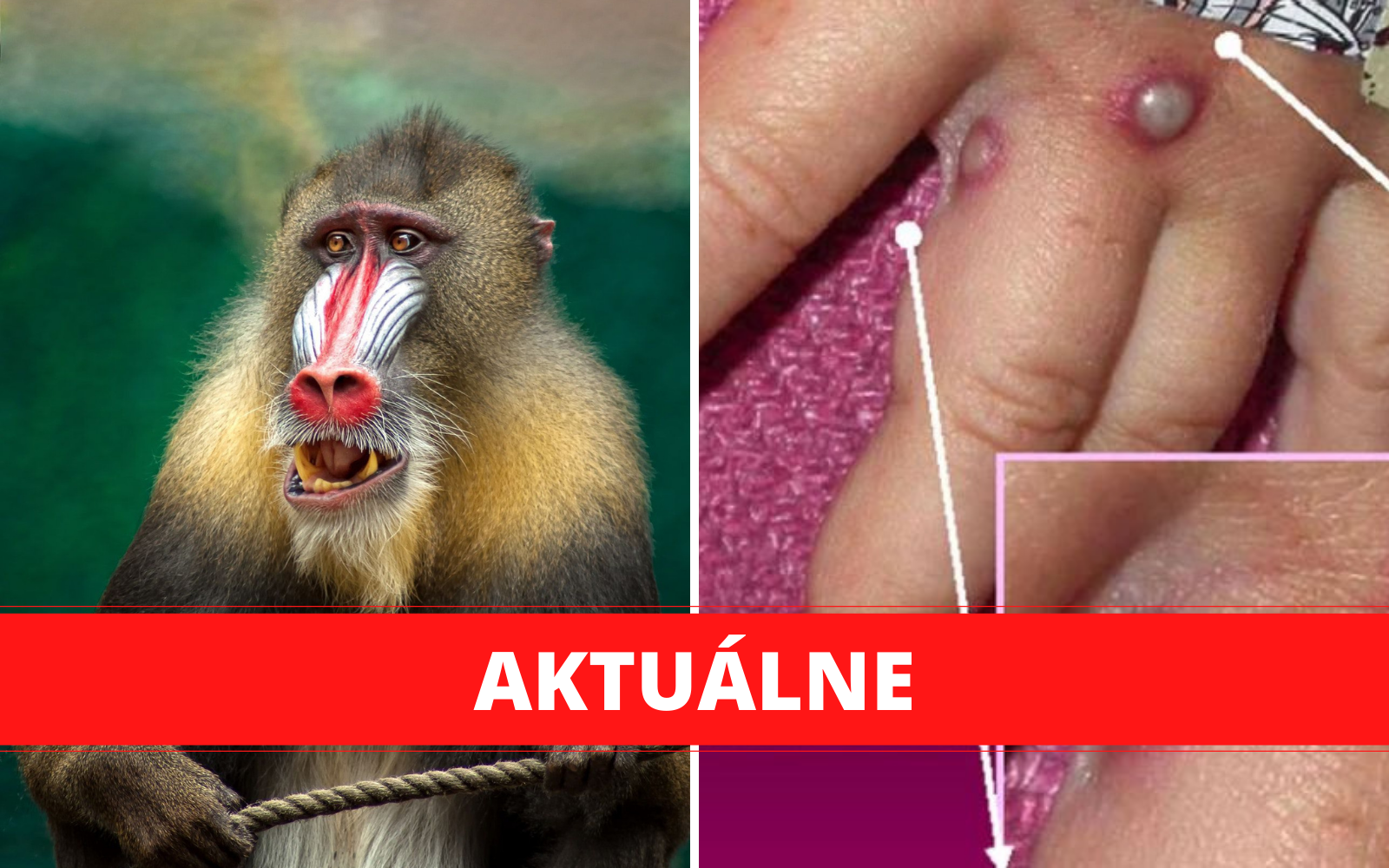 opicie kiahne aktualne