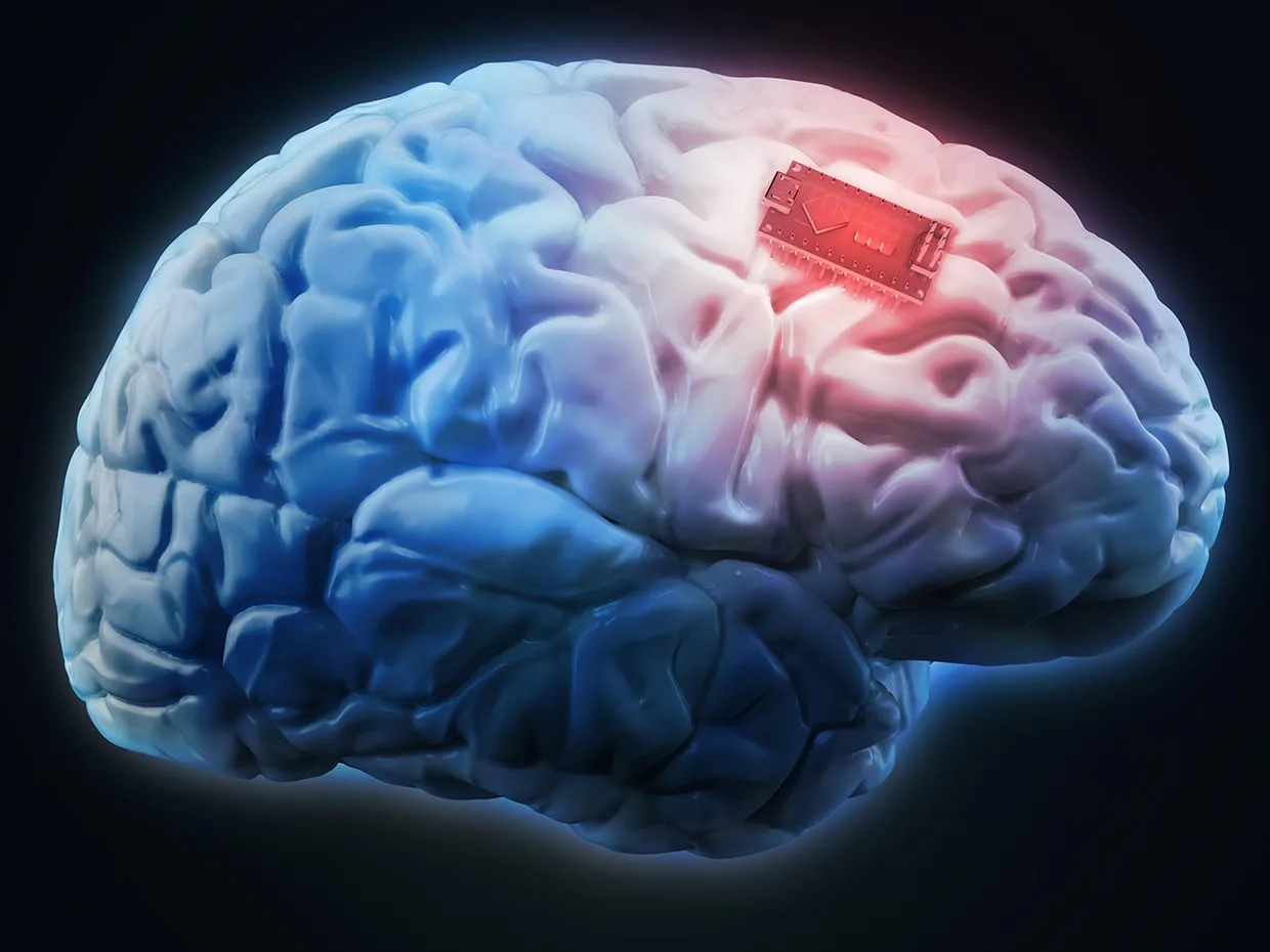 mozgovy implantat jpg