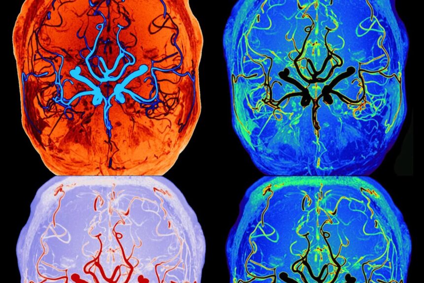 Mozog počas spánku