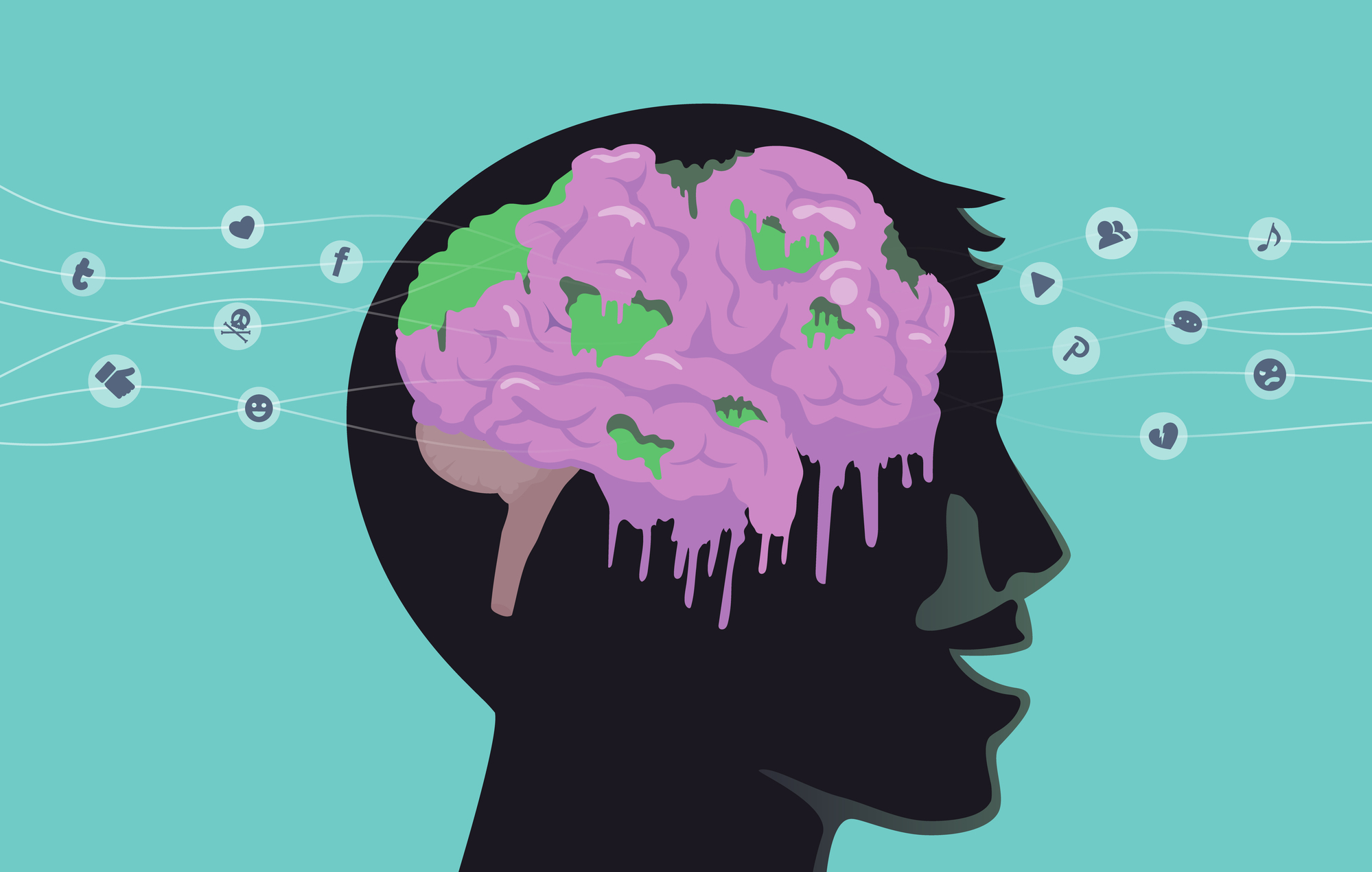 Brain rot